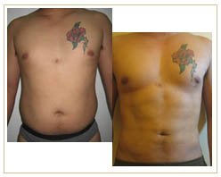 Slider image (9) Roura DermSurgery